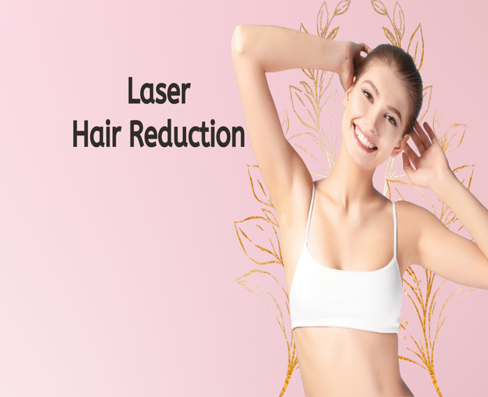 Laser Hair Removal
